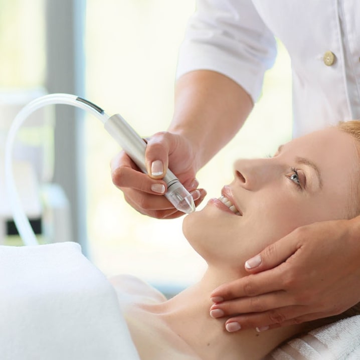 Dermabrasion Dermabrasion